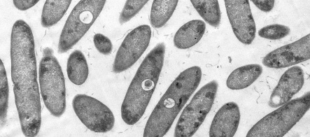 Экологический детокс: бактерии в Сибири чистят ядовитые отходы горнодобычи