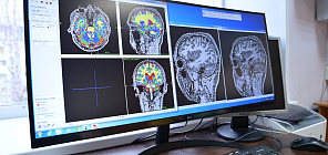 Нейробиологи ТГУ формируют «атлас» головного мозга человека